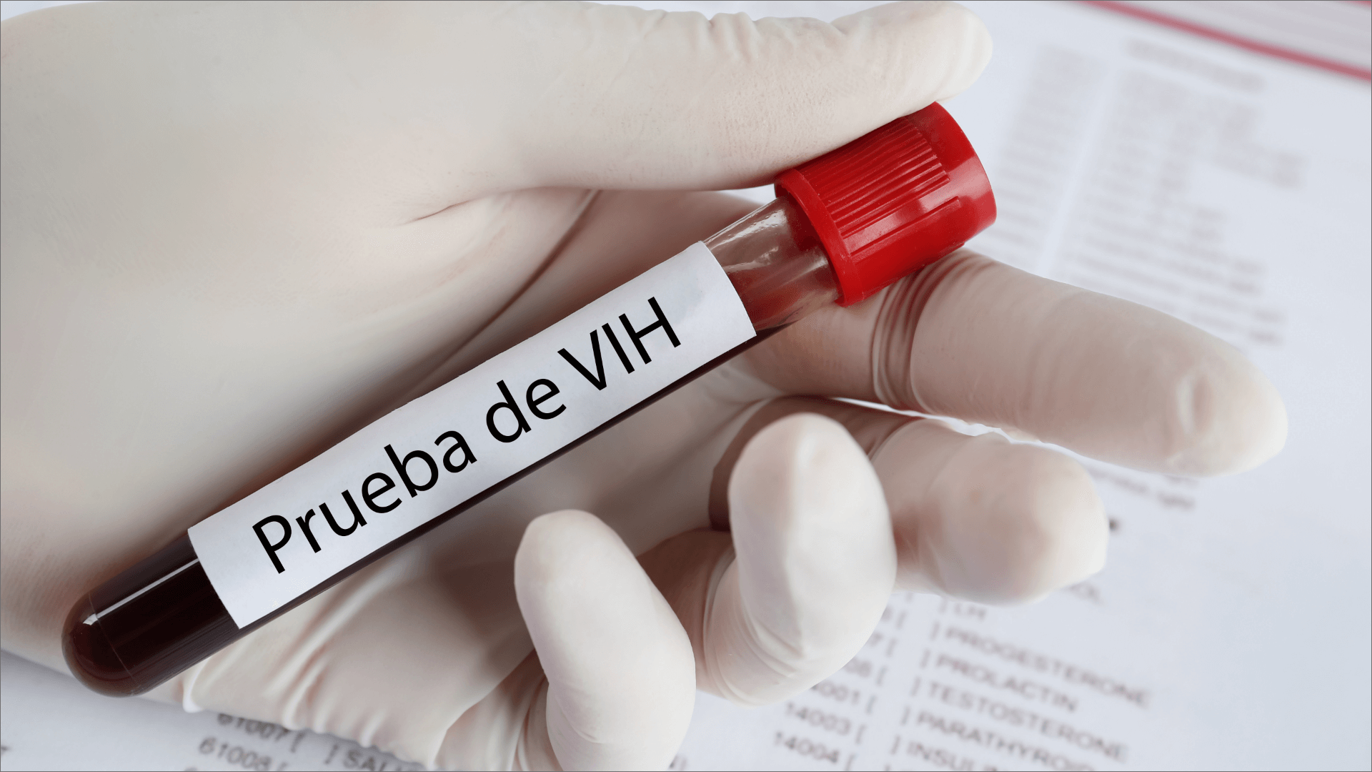 pruebas_VIH